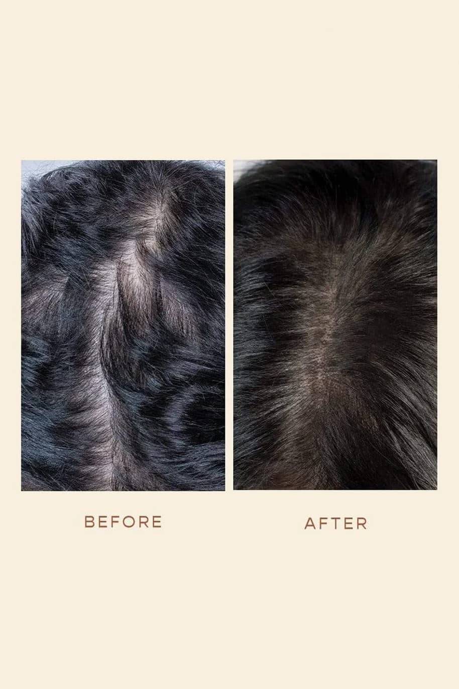 100% Organic Hair Growth Oil