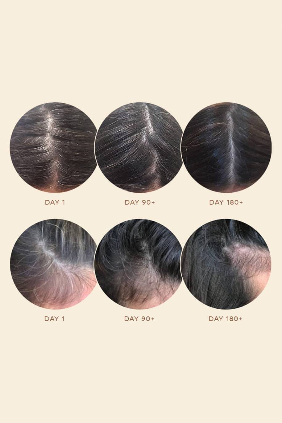 100% Organic Hair Growth Oil